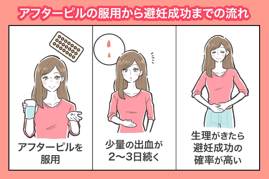 アフターピル成功の流れ