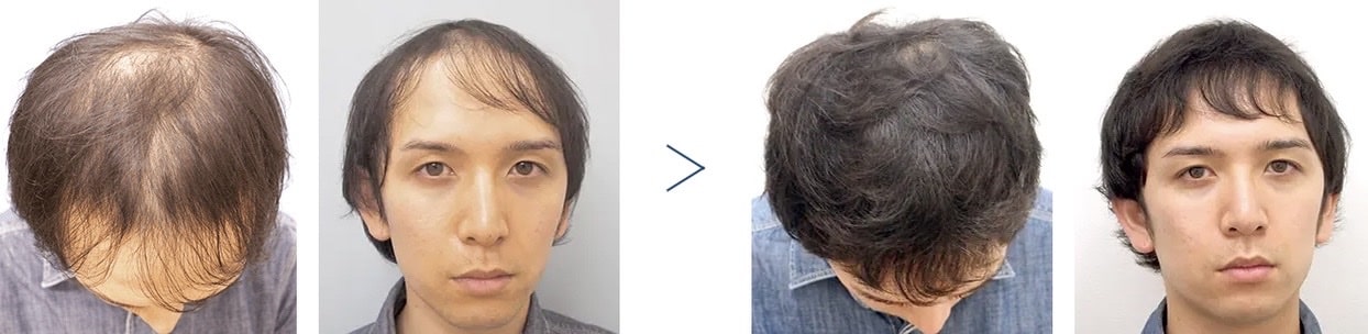 AGAスキンクリニック