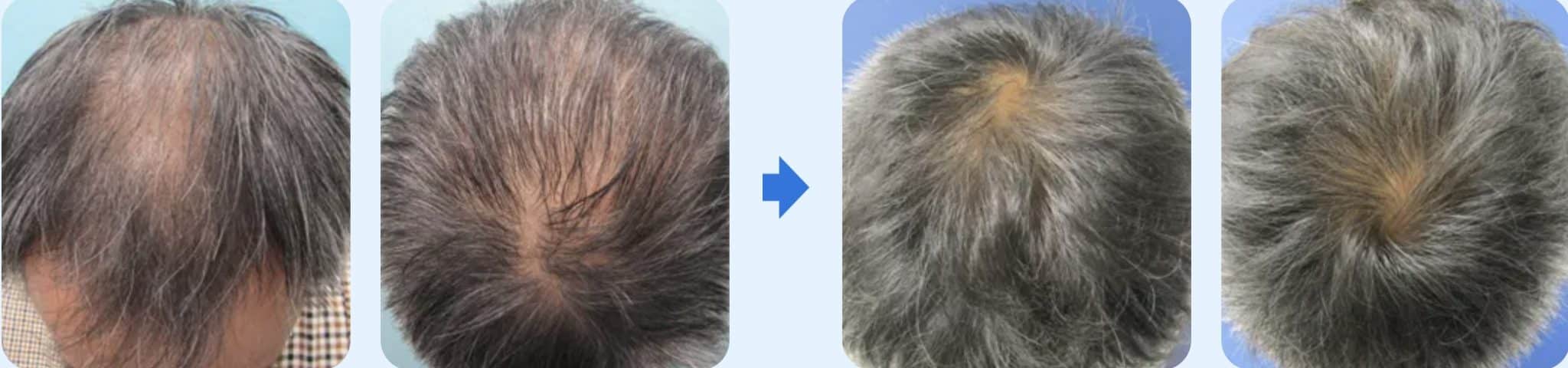 ゴリラクリニック