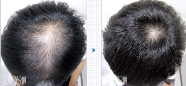 男たちの美容外科