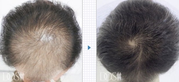 男たちの美容外科