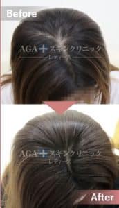 AGAスキンクリニックレディース