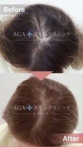 AGAスキンクリニックレディース