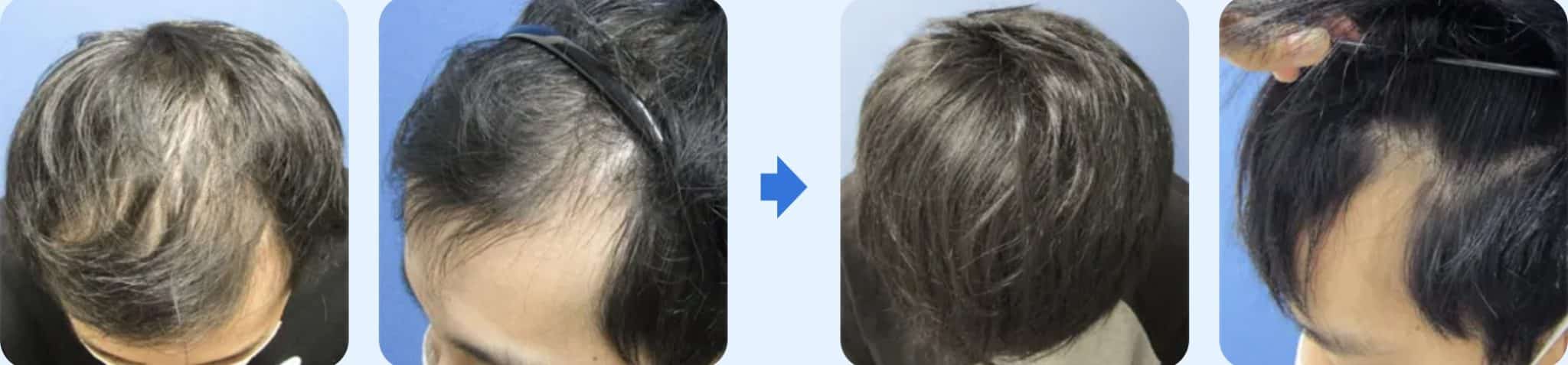 ゴリラクリニック