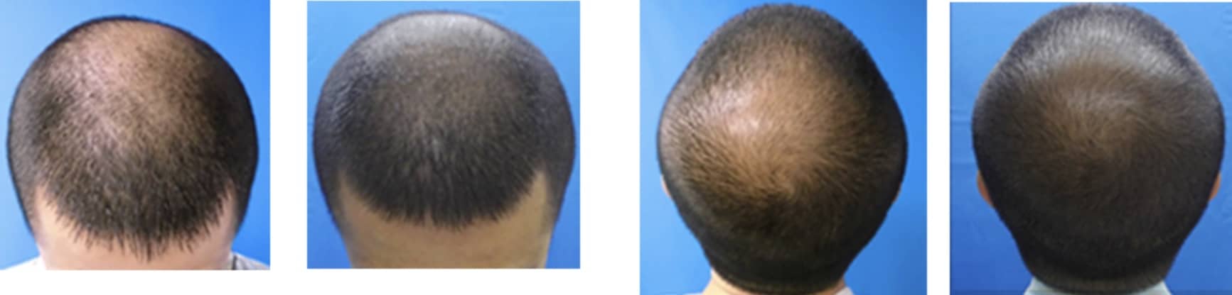 ガーデンクリニック発毛医療外来