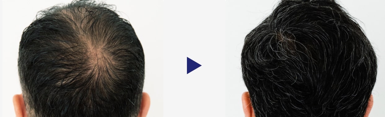 イースト駅前クリニック　症例写真