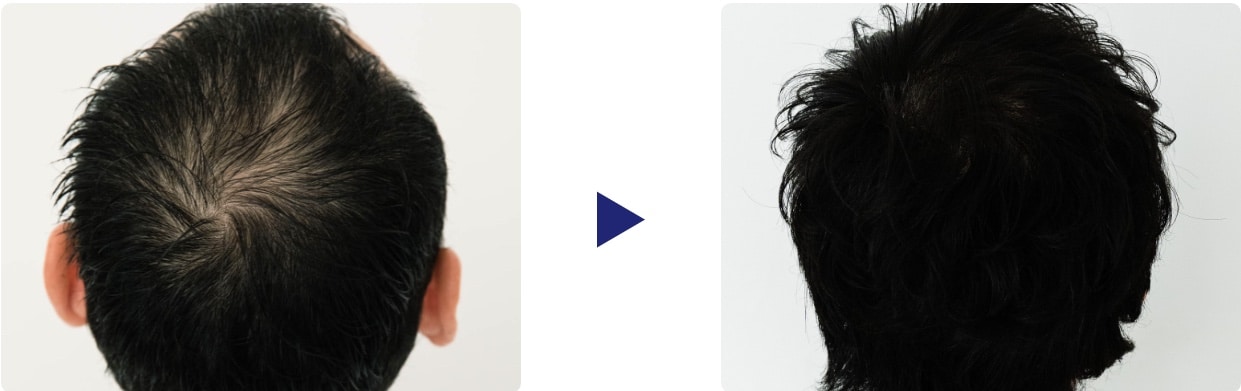 イースト駅前クリニック　症例写真